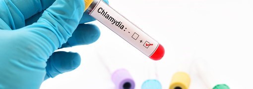 בדיקת כלמידיה (Chlamydia Diagnostic Test) - תמונה